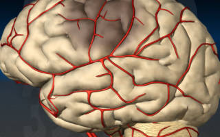Как бороться с Болезниом сосудов головного мозга