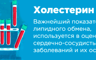 Как пишется холестерин в анализе крови