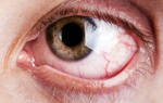 Лечение глаз при сахарном Болезние
