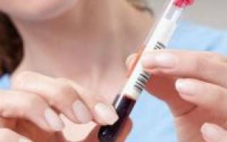 Инсулин норма у женщин в крови