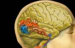 Болезни сосудов головного мозга последствия