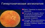 Гипертоническая ангиопатия сетчатки обоих глаз лечение