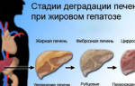 Жировая инфильтрация печени и поджелудочной железы лечение