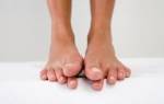Онемение пальцев ног при сахарном Болезние