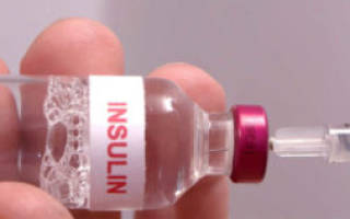 Что такое инсулин его роль в организме